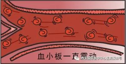 【科普】血小板是正常值的三倍？專家提醒小心血栓和出血！