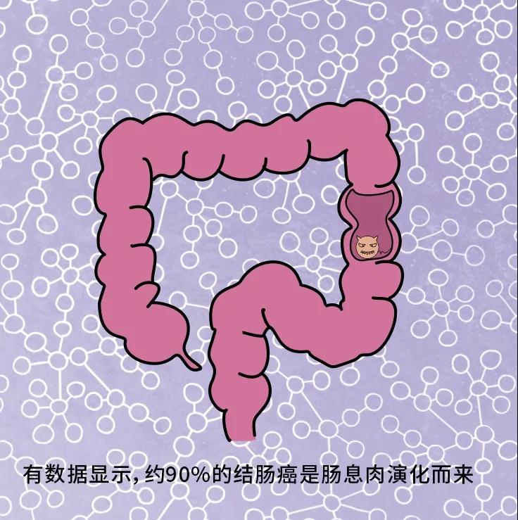 奪走“黑豹”生命的結(jié)腸癌，到底什么來頭？