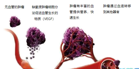 晚期腫瘤為什么會(huì)復(fù)發(fā)轉(zhuǎn)移？