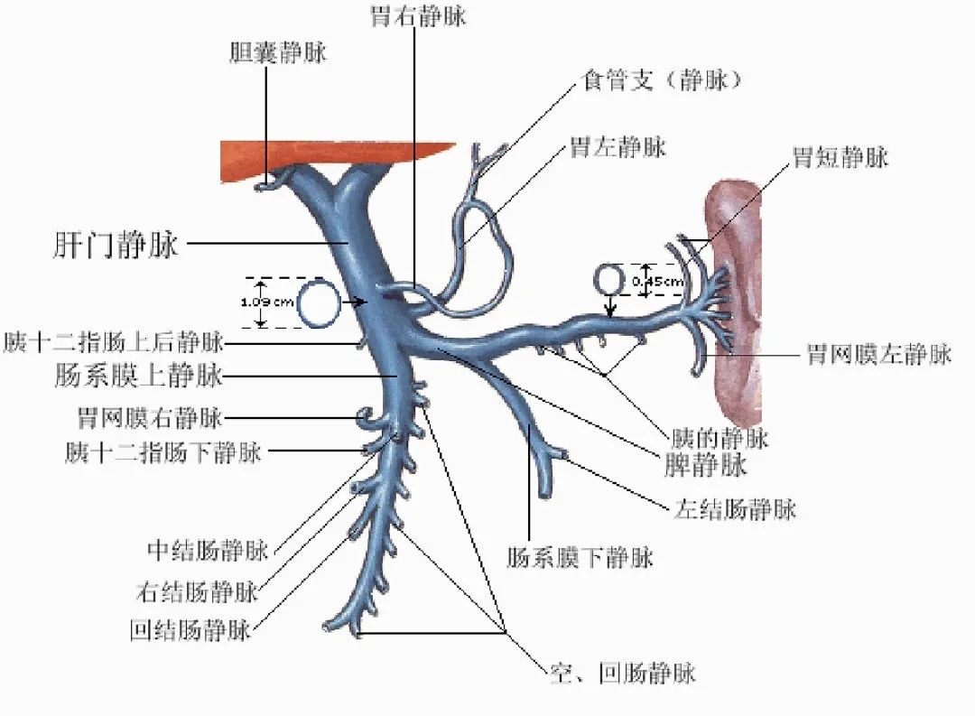 反復(fù)嘔血、黑便怎么辦？TIPS手術(shù)能解決