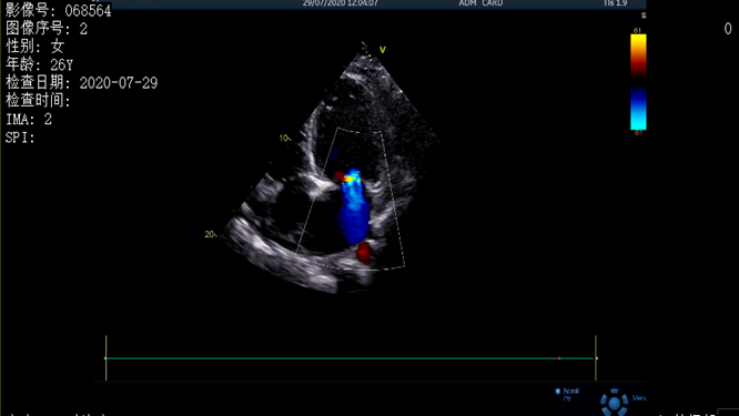 心電圖異常，心臟卻沒事，罪魁禍?zhǔn)资恰?>
				             </a>
                <div   id=