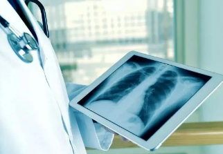 健康呼吸④體檢發(fā)現(xiàn)肺結(jié)節(jié)，我該怎么辦？