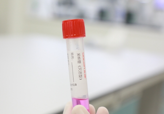 支原體感染檢測(cè)手段知多少？