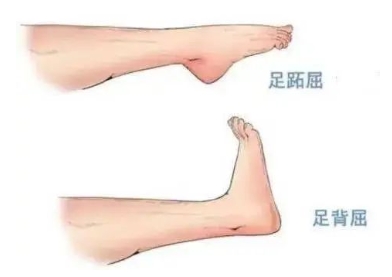 扭胯小連步、動感搖花手……“科目三”雖火，運動損傷也要防！