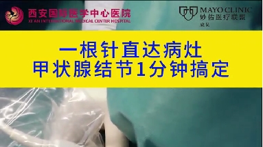 1根針直達病灶 甲狀腺結(jié)節(jié)1分鐘搞定